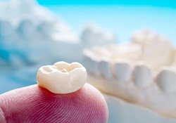 Porcelain crown balanced on fingertip
