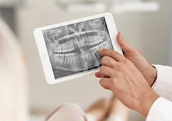 Digital dental x-rays on tablet computer