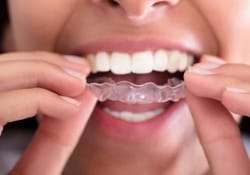 woman holding aligner