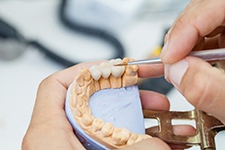 Dentist working on dental bridges in Downers Grove