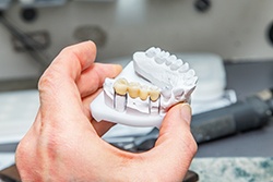 Dentist in Downers Grove holding a dental bridge