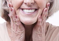 Model smile with partial denture