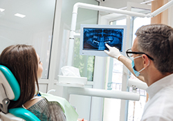 implant dentist in Downers Grove showing a patient their X rays
