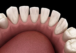 Diagram showing gaps between teeth