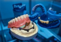 A closeup of denture models