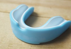 Mouthguard for protecting dental implants in Downers Grove