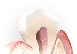 Animation of inside of tooth