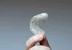 Hand holding an occlusal splint