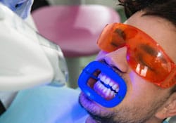 whitening treatment