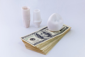 dental implant on a pile of money