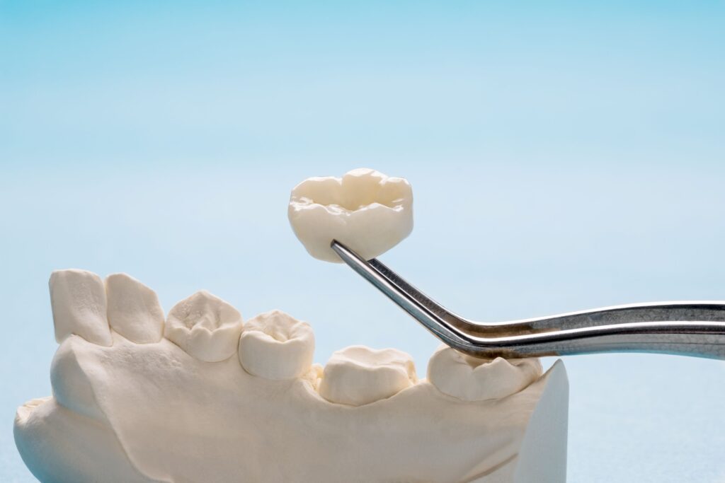 Forceps grasping dental crown hovering over model tooth
